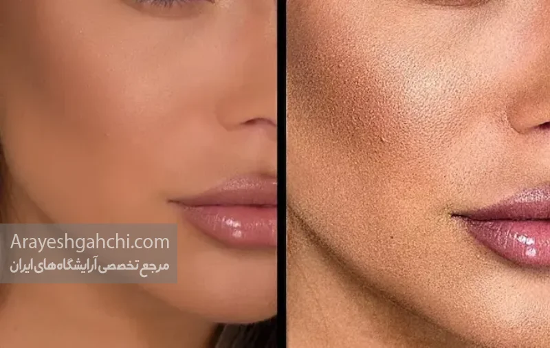 کیکی شدن کرمپودر