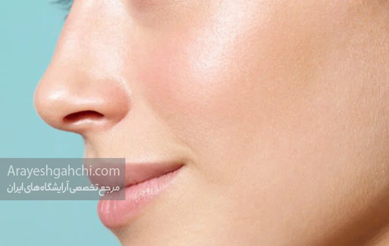 کرم ضدچروک